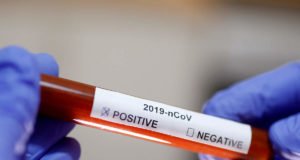 తబ్లిగి జమాత్ వ్యక్తి వల్ల 40 మంది డాక్టర్లు,నర్సులు క్వారంటైన్ కి తరలింపు..