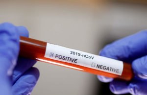 తబ్లిగి జమాత్ వ్యక్తి వల్ల 40 మంది డాక్టర్లు,నర్సులు క్వారంటైన్ కి తరలింపు..